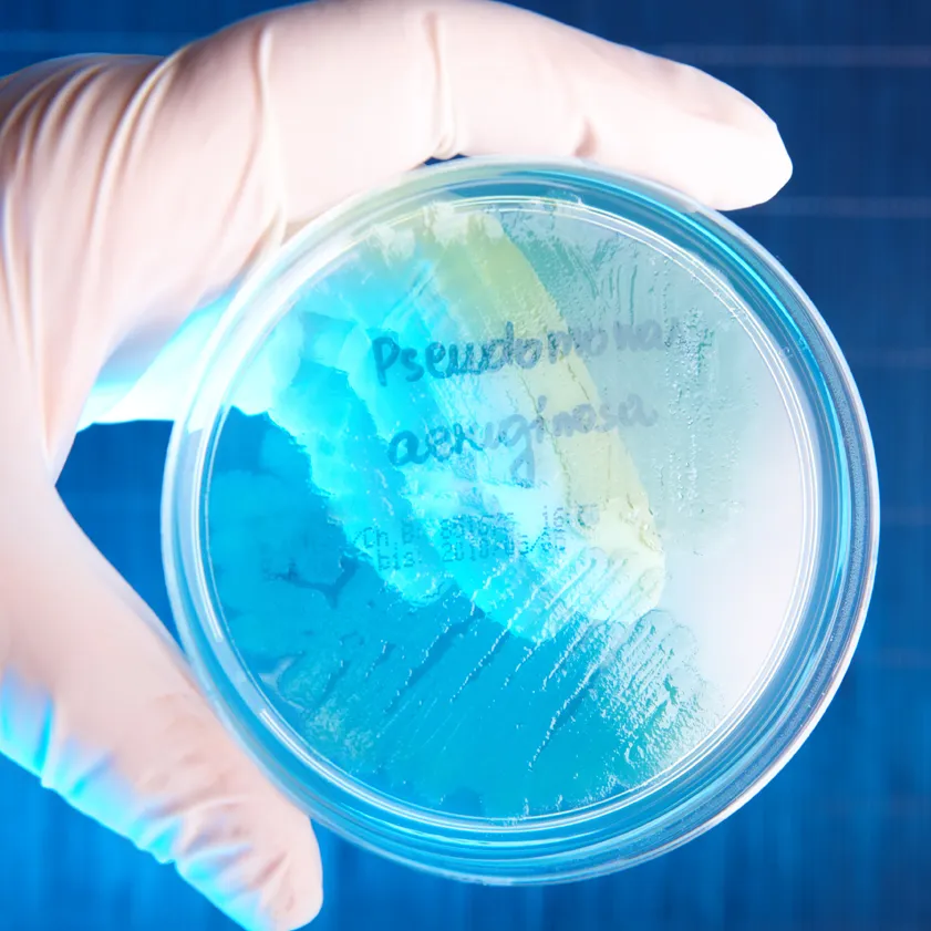 Reducing the risk of Legionella